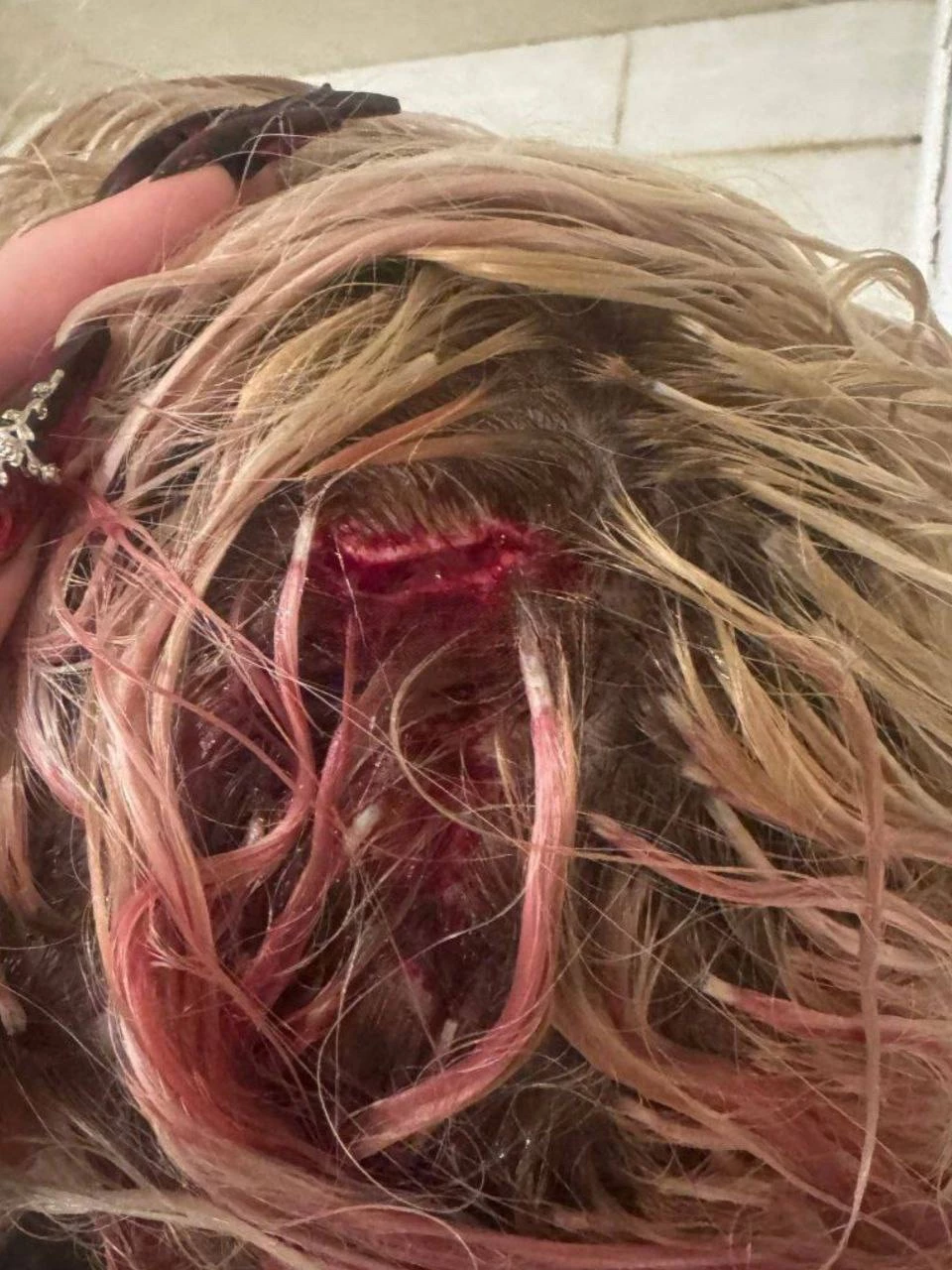 В Белгороде мужик сломал швабру об голову девушки за отказ в сексе — потом полез с ножом!