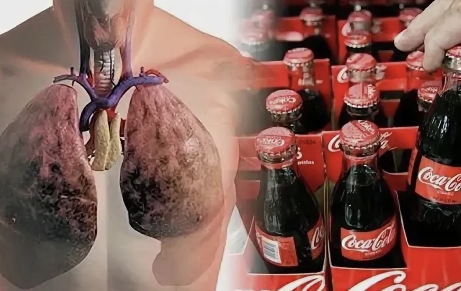 Врачи шокировали: больше 200 мл колы в день — и кости как у старика!