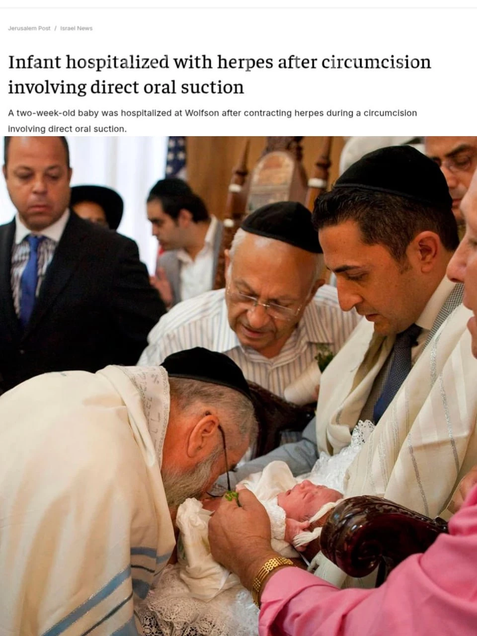 Раввин отсосал кровь у младенца во время обрезания — ребёнок подхватил герпес и попал в реанимацию!