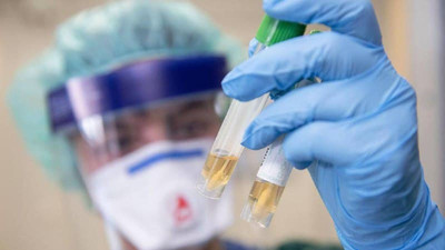 Глава ВОЗ заявил, что исключать искусственное происхождения коронавируса преждевременно