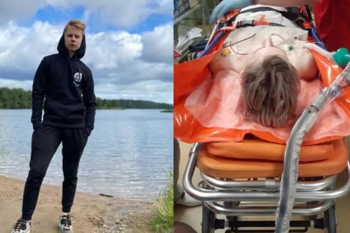 Под Великим Новгородом парень выстрелил в своего одноклассника из ружья для подводной охоты.